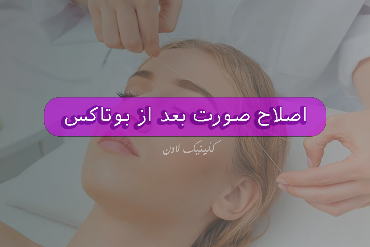 اصلاح صورت بعد از تزریق بوتاکس چگونه است؟ - مرکز زیبایی لادن